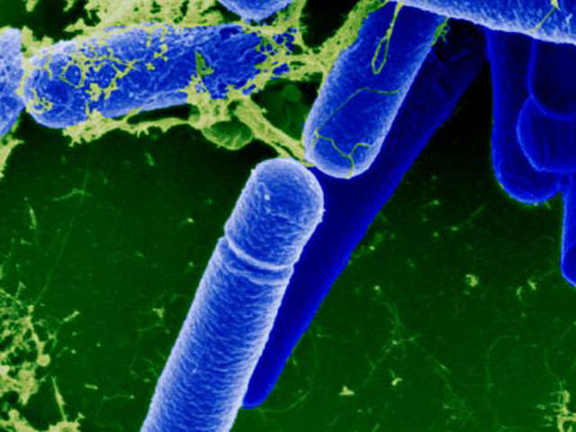 бактерии в моче