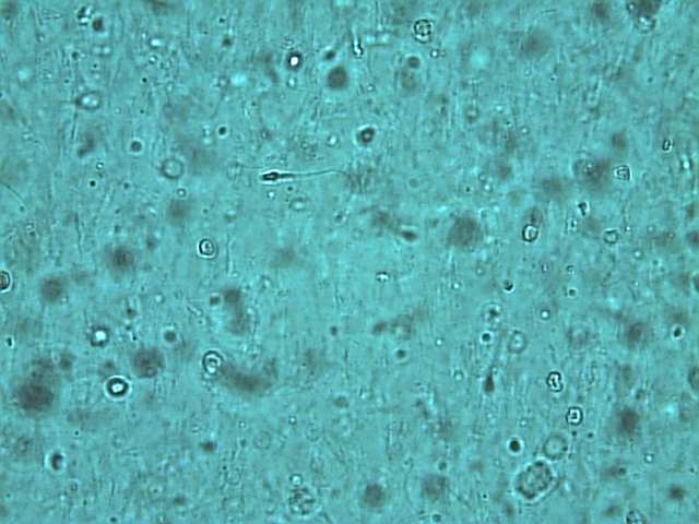 Сперма под микроскопом