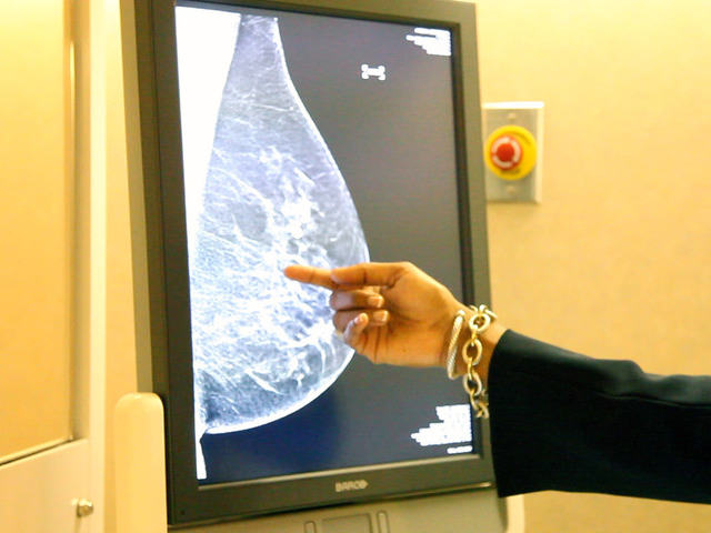 3Д - маммография