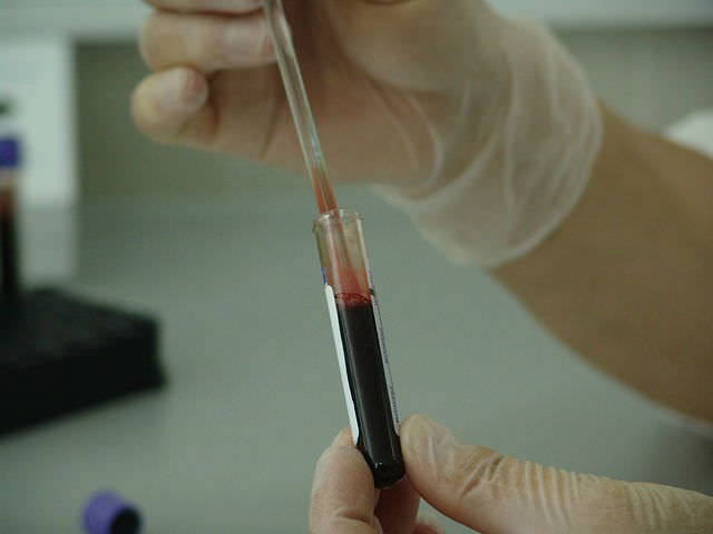 тест крови