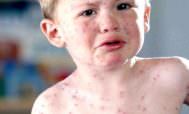 анализ на аллергены у ребенка