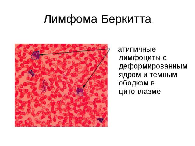 Атипичные клетки