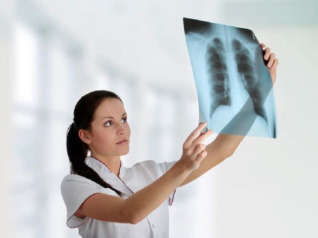 можно ли делать рентгенофлюорографию беременным
