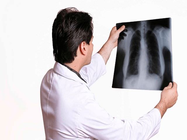 как сделать ренгенографию грудного отдела позвоночника 