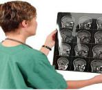 Томография мозга